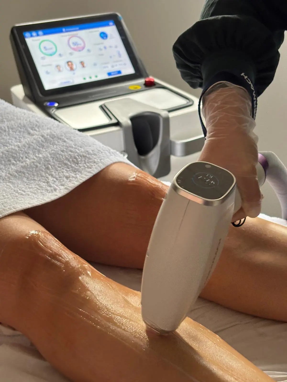 Épilation laser